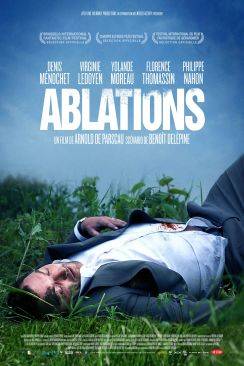 Ablations flemmix