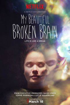 My Beautiful Broken Brain flemmix