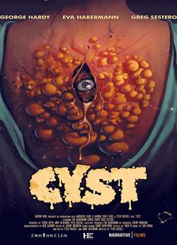 Cyst flemmix
