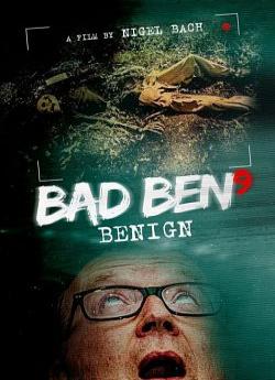 Bad Ben: Benign flemmix