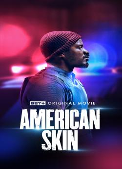 American Skin flemmix