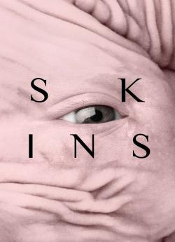 Skins flemmix