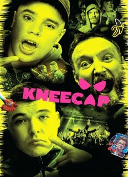 Kneecap flemmix